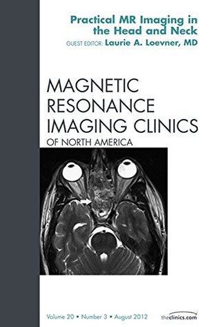 Download Head and Neck MRI, An Issue of Magnetic Resonance Imaging Clinics - Laurie A. Loevner | PDF