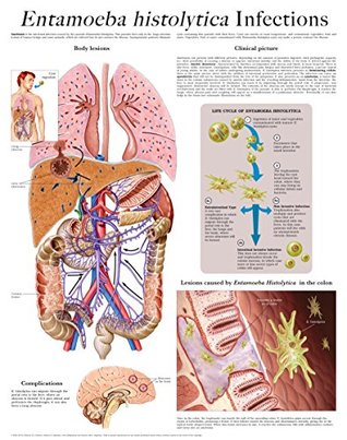 Download Entamoeba histolytica Infections e-chart: Full illustrated - HC-HealthComm | PDF